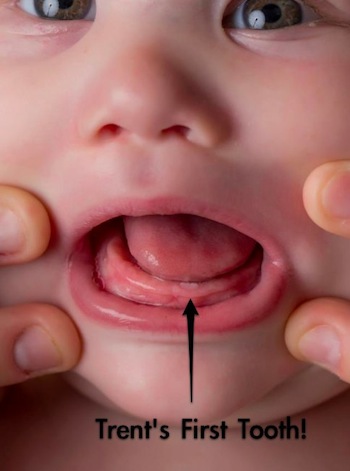 Tooth!