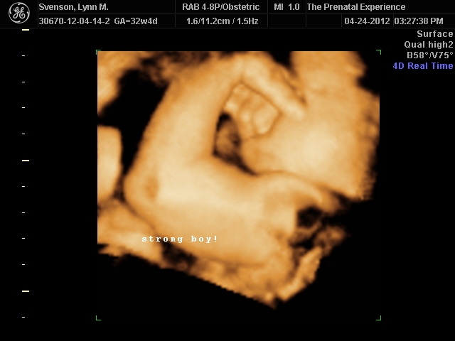 3D Ultrasound 14
