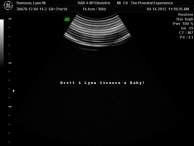 4D Ultrasound Session screen