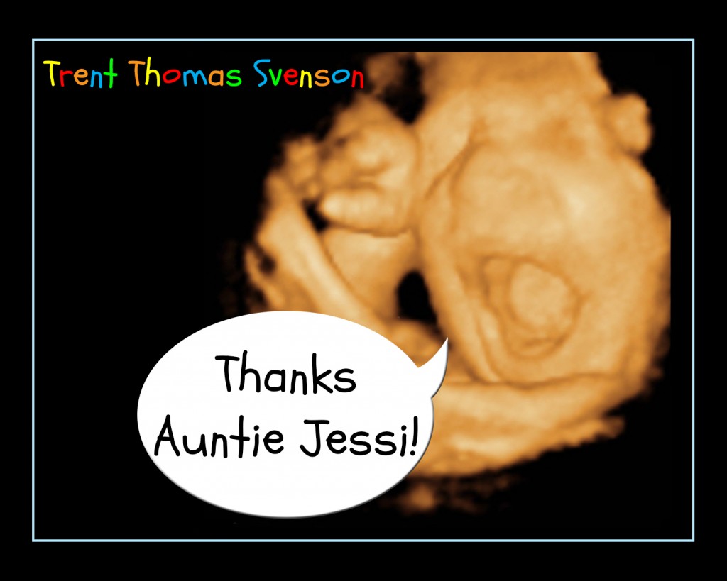 Baby Shower Thank you cards ultrasound